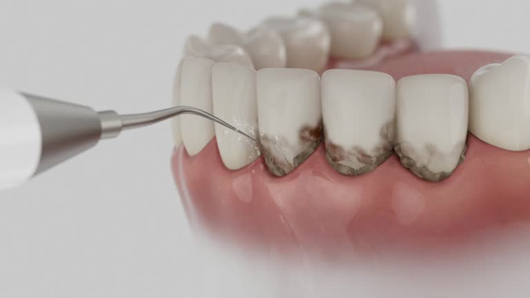 Reliable Dental Implants contractor in Ocala Estates, FL by Smile Center Dentistry